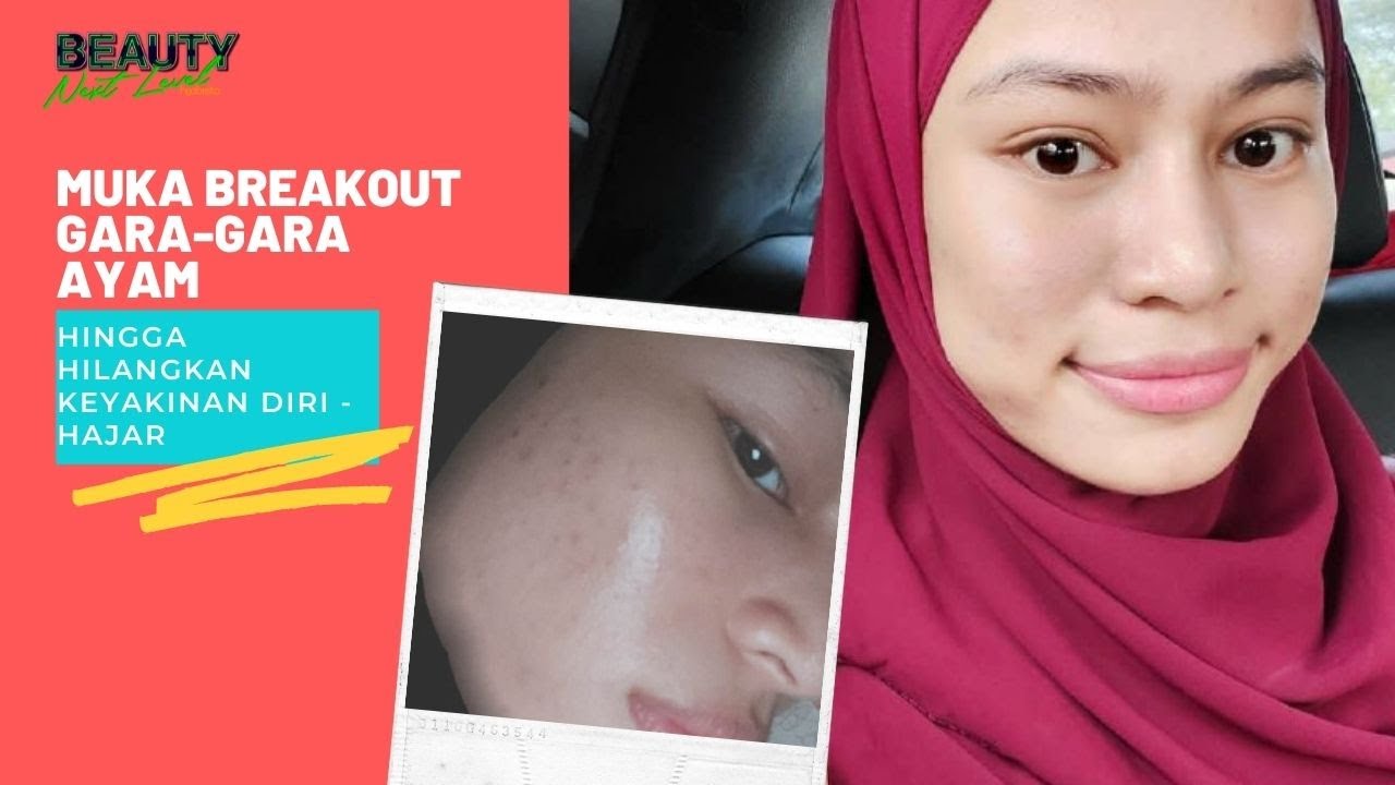 MUKA BREAKOUT GARA-GARA AYAM